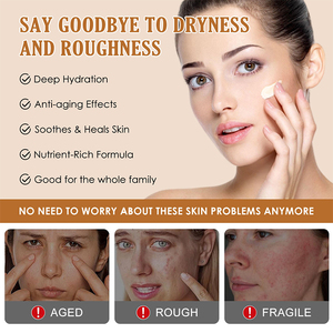 Bálsamo Humectante de Sebo Batido de Res Alimentada con Pasto, Miel, Manteca de Karité, Glicerina y Colágeno para Piel Sensible, Marca Privada Personalizada - Product Image 2