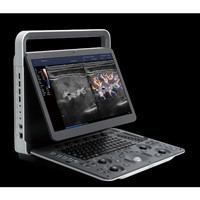 Ecógrafo Inteligente Sonoscape E2 con Doppler Color al Mejor Precio