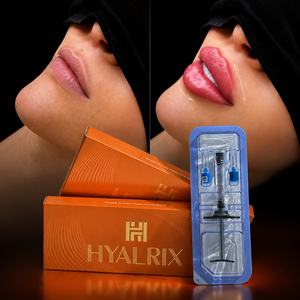 Gel <span class=keywords><strong>de</strong></span> Ácido Hialurónico Reticulado, Relleno Dérmico Antienvejecimiento e Iluminador para <span class=keywords><strong>Aumento</strong></span> <span class=keywords><strong>de</strong></span> <span class=keywords><strong>Labios</strong></span> y Uso Facial OEM - Product Image 3