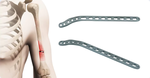 Placa de Bloqueo Humeral <span class=keywords><strong>Proximal</strong></span> de Titanio Mínimamente Invasiva, Implante de Titanio Puro para Fijación Estable - Product Image 3