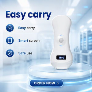 Handheld Pocket Linear Convex Phased Probe <strong>Ultrasound</strong> Scanner 3 in 1 <strong>Ultrasound</strong> Machine Doppler Portable Pocket <strong>Ultrasound</strong> - Product Image 2