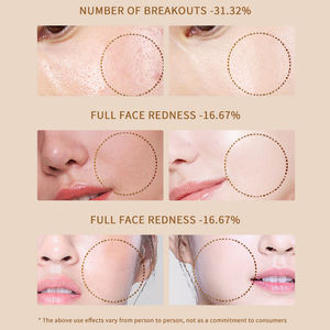 ساونا الأشعة تحت الحمراء المحمولة للاستخدام المنزلي وظيفية تعمل بالأشعة تحت الحمراء مع جهاز EMS لرفع الوجه ، - Product Image 4