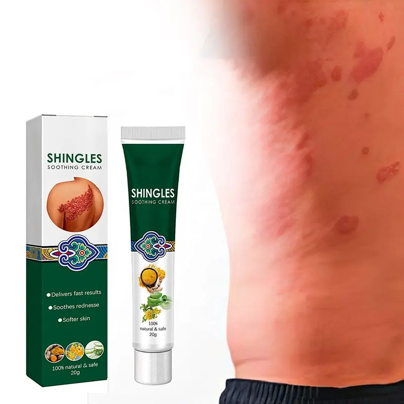 Trung Quốc thảo dược làm sạch da mặt sức khỏe bệnh vẩy nến viêm da eczema chăm sóc da bệnh vẩy nến Thuốc mỡ Kem