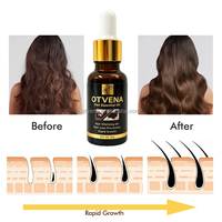 OTVENA 100% Efektif Organik Vegan 2026 Perawatan Penumbuh Rambut Efek Terlihat Anti Rambut Rontok Minyak Penumbuh Rambut Jahe Untuk Penggunaan di Rumah
