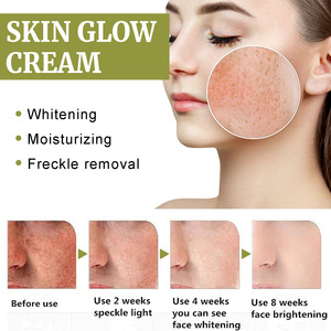 Private Label WestMonth Black Spot Remoção e pele Lightening Creme desaparece manchas escuras e <span class=keywords><strong>melasma</strong></span> para Maquiagem e Uso Beleza - Product Image 3