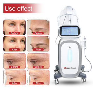 Mesin peremajaan kulit wajah, oksigen Aqua O2 kupas peralatan kecantikan mengupas mesin Jet oksigen hiperbarik wajah - Product Image 6