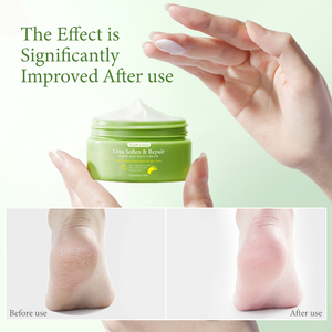 Crème pour les pieds à la vente chaude, crème pour éliminer les fissures des pieds, crème adoucissante pour les pieds, protection à l'huile d'arbre à thé et réduction du gonflement, crème pour les pieds à l'huile d'arbre à thé - Product Image 6