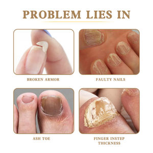 West Month Repair Oil Pen Main et Pied Gris Clean Soft Rotten Nails Solution de soin des <span class=keywords><strong>ongles</strong></span> <span class=keywords><strong>d</strong></span>'orteils épaississants - Product Image 2