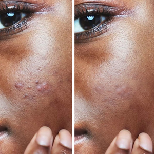 GUOCUI BIO TECH organik doğal sıkılaştırıcı anti-kırışıklık beyazlatma nemlendirici derin nemlendirici vitamin yağı + kuşburnu yağı + lavanta yağı - Product Image 4