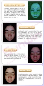 Multifunctional Skin Analyzer Machine Facial Type Skin Problems New Technology Facial Analyzer Portable Skin Tone Detector - Product Image 5