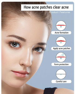 Patchs Hydrocolloïdes Anti-Acné et Anti-Imperfections à Prix Abordable, Lot de 20 – Meilleures Ventes - Product Image 4