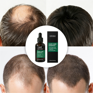 Olio <span class=keywords><strong>per</strong></span> la Crescita dei <span class=keywords><strong>Capelli</strong></span> a Marchio Privato, Siero Organico <span class=keywords><strong>per</strong></span> la Ricrescita e il Trattamento della Calvizie, <span class=keywords><strong>Cura</strong></span> Rinforzante <span class=keywords><strong>per</strong></span> il Cuoio Capelluto - Product Image 4