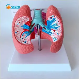 Tıbbi bilim insan sağlıklı akciğer hasta akciğer kontrast modeli iç organ diseksiyon gösteri öğretim ile karşılaştırıldığında