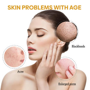 Vegan Rice Puffs <span class=keywords><strong>Limpiador</strong></span> facial <span class=keywords><strong>espumoso</strong></span> Aceite de <span class=keywords><strong>gel</strong></span> amigable con el acné suave para la limpieza de poros faciales Nutritiva Piel delicada - Product Image 3