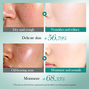 Kit Facial de Ácido Hialurónico BIOAQUA OEM de Marca Privada para Mujeres, Productos de Belleza Hidratantes, Reparadores y Reafirmantes, Set de Cuidado Facial para la Piel - Product Image 5