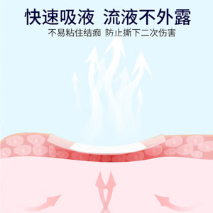 Pansement stérile médical Hai&Shi Hai&Nuo, auto-adhésif jetable grande taille, respirant, pour soins post-opératoires - Product Image 2