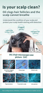 Portable Advanced Hair Loss Analyzer with Scalp Care Function for Home and Salon Skin Diagnosis Lenses Detailed Scalp Analysis - Product Image 5