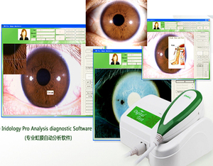 Máy Quét Mắt <span class=keywords><strong>Iris</strong></span> Cập Nhật Mới - Product Image 6