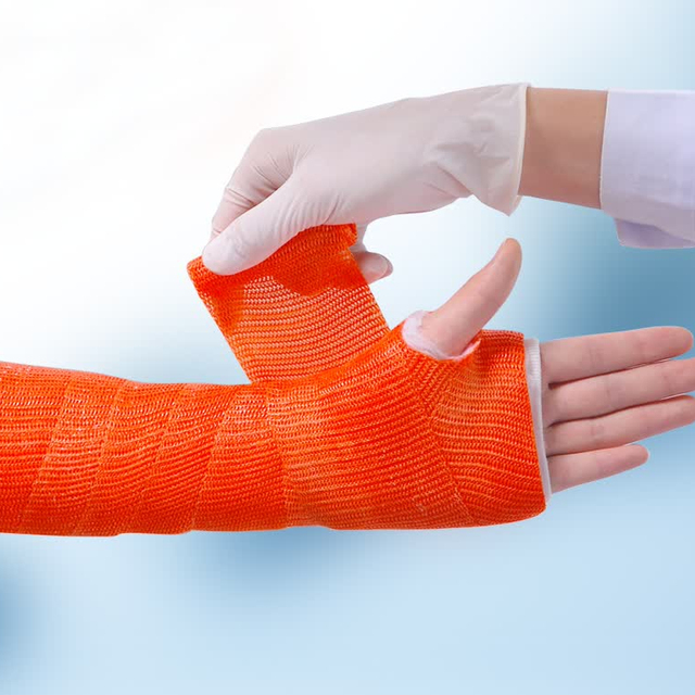 Fiberglass Cast