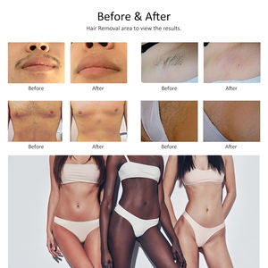 เครื่อ<span class=keywords><strong>ง</strong></span>กำจัดขนเลเซอร์ไดโอดแบบไม่ใช่คริสตัล3ความยาวคลื่น1800วัตต์ - Product Image 6