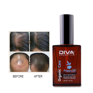 Aceite Natural de Argán para el Crecimiento del Cabello <span class=keywords><strong>DIVA</strong></span>, Previene la Caída del Cabello, Repara el Cabello Dañado, Acepta OEM/ODM, Aceites Esenciales Orgánicos para el Cabello - Product Image 2