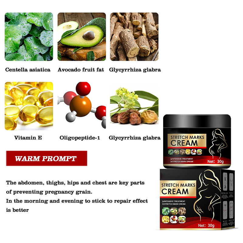 natural organic skin repair anti vergeture for pregnancy repair scar mark stretch mark remover cream