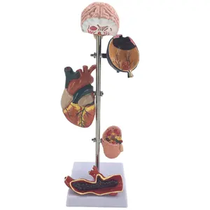 高血圧モデル5部高血圧の病理学的変化脳眼心臓腎臓血管内臓モデル