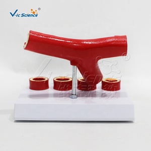 Modelo de Trombosis, Modelo Anatómico de <span class=keywords><strong>Arteriosclerosis</strong></span> Cardiovascular Humana - Product Image 4