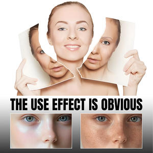 Suero Facial de Niacinamida de Marca Privada con Glicerina Líquida, Antienvejecimiento, Reafirmante, Iluminador, para Piel Madura - Product Image 4