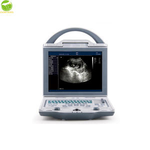 Échographe portatif de KX5600V/équipement tenu dans la main vétérinaire d'ultrason - Product Image 1