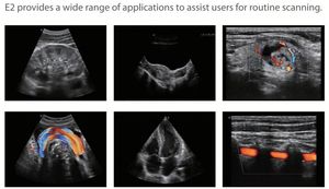 E1 E2 E2V Sonoscape Scanner à ultrasons grand écran Portable <span class=keywords><strong>4D</strong></span> Machine à ultrasons médicale - Product Image 3