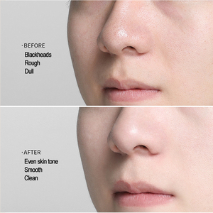 Ampolla Facial 3 en 1 de Vidrio con Aceite Exfoliante para Masajes y Spa, Nutrición para Piel Seca, Cuidado de Puntos Negros Sensibles |   Fabricante OEM - Product Image 2