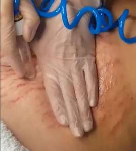 चेहरे की साफ सेल्युलाईट कमी शरीर के लिए प्रमाणित डेस्कटॉप वैक्यूम मालिश मशीन को स्लिमिंग कर दिया - Product Image 5