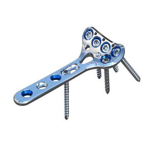 Instrumentos Médicos, Kit Quirúrgico Óseo, Implantes Ortopédicos de Alta Calidad, Implantes Quirúrgicos Ortopédicos para Columna Vertebral - Product Image 1