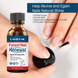Kit de solución líquida para el cuidado de los pies, tratamiento anti-hongos para uñas, pedicura, tratamiento de hongos en el hogar, gran oferta - Product Image 2