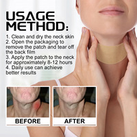 Patch naturel de drainage des ganglions thyroïdiens, 20 autocollants à base de plantes pour le soulagement des gonflements du cou et les soins lymphatiques
