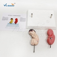Modelo Comparativo de Feticos Saludables y Feticos de Madre Fumadora para Fines de Entrenamiento