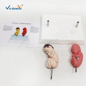 Modèle de démonstration comparatif de fœtus en bonne santé et de fœtus fumeurs à des fins de formation - Product Image 3