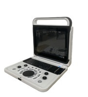 Ecógrafo Portátil en Blanco y Negro Mindray BOU50B para Diagnóstico Médico