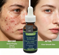 Sérum Traitant l'Acné au Théier LOGO 30ml – Acide Salicylique BHA pour Contrôler l'Excès de Sébum, Estomper les Marques d'Acné, Éclaircir et Minimiser les Pores – Sérum Visage
