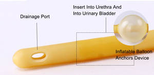 एकल उपयोग चिकित्सा 3-वे डबल गुब्बारे सिलिकॉन लेटेक्स फोली जल निकासी कैथेटर ईओस 400 मिमी लंबाई को कीटाणुरहित करता है - Product Image 2