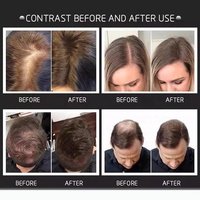 Fibres Capillaires Volumisantes à la Kératine de 27,5g avec Logo Personnalisé, Marron Blanc Noir, Poudre en Spray pour Cheveux Clairsemés
