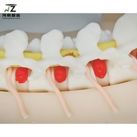 Modèle de formation à la chirurgie endoscopique transforaminaire, modèle UBE, simulateur de formation à l'endoscopie transforaminaire