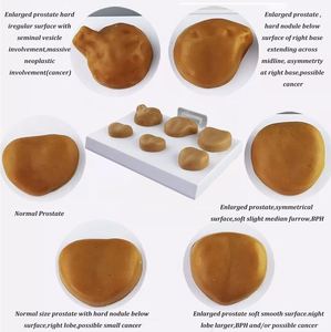 KyrenMed laki-laki gelap prostat ujian mandiri Model anatomi medis urologi prostat untuk studi kanker prostat - Product Image 3