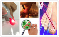 Appareil laser à diode 1470 nm pour l'onychomycose, dispositif de podologie, traitement des ongles fongiques, machine d'élimination des varices 980 nm