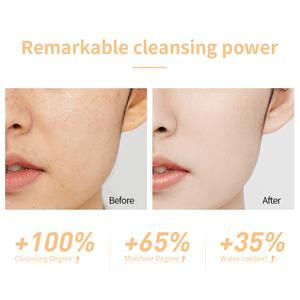 Custom Kojic Acid 3 in 1 <strong>Facial</strong> <strong>Cleanser</strong> Essence Skin Tightening <strong>Simple</strong> Face Wash <strong>Facial</strong> Salycic Acid Hydrated Foaming <strong>Cleanser</strong> - Product Image 6