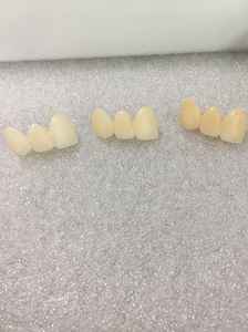 Blocchi di Zirconia Multistrato 3D Plus YUCERA Avanzati per Risultati Dentali Estetici Ottimali - Product Image 3