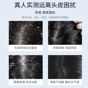 ชุดแชมพูและครีมนวดผม WWP ควบคุมความมัน ผสมไฮยาลูรอนิค แอซิด กลิ่นน้ำหอมติดทนนาน <span class=keywords><strong>ขจัด</strong></span><span class=keywords><strong>รังแค</strong></span> ผมนุ่มสลวย ใช้ได้กับผิวกาย - Product Image 3