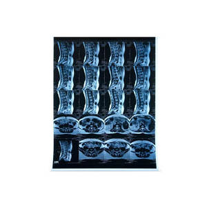 CT/<span class=keywords><strong>DR</strong></span>/MR Departamento Láser Película blanca 8X10 8*10 pulgadas Láser CT/CR/<span class=keywords><strong>DR</strong></span> Película DE RAYOS X médica para hospital - Product Image 5