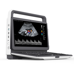 Ecógrafo Portátil de la Marca Zoncare M7, Proveedor Chino al por Mayor, Sistema de Ecografía Veterinaria Doppler a Color con Monitor LCD de 15.6 Pulgadas - Product Image 6